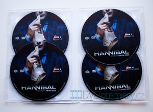 Hannibal 1. série (4 DVD) - seriál